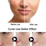 Turmeric-Freckle-Whitening-Serum-Fade-Dark-Spot-Removal-Pigment-Melanin-Correcting-Facial-dr-berg-Essence-Beauty-Face-Skin