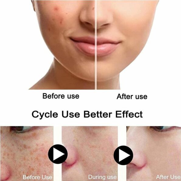 Turmeric-Freckle-Whitening-Serum-Fade-Dark-Spot-Removal-Pigment-Melanin-Correcting-Facial-Essence-Beauty-Face-Skin-1.jpg
